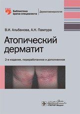 Альбанова В. І., Пампура А. Н. Атопічний дерматит. Бібліотека лікаря-спеціаліста 2020 рік 34 фото
