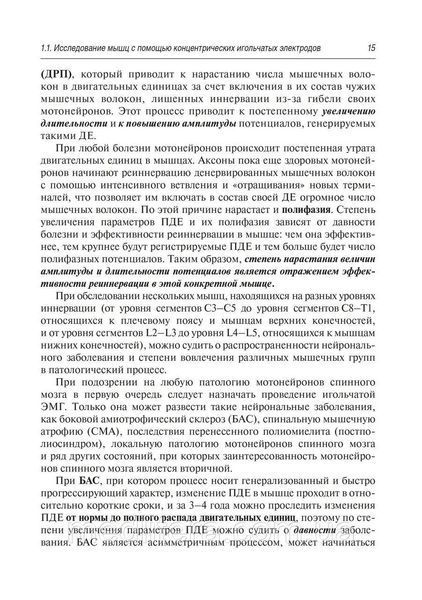 Клінічна електромографія для практичних неврологів/А. Г. Санадзе, Л. Ф. Касатина. &mdash; 3-й од. NF0017839 фото