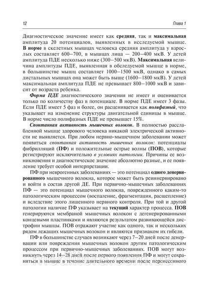 Клінічна електромографія для практичних неврологів/А. Г. Санадзе, Л. Ф. Касатина. &mdash; 3-й од. NF0017839 фото